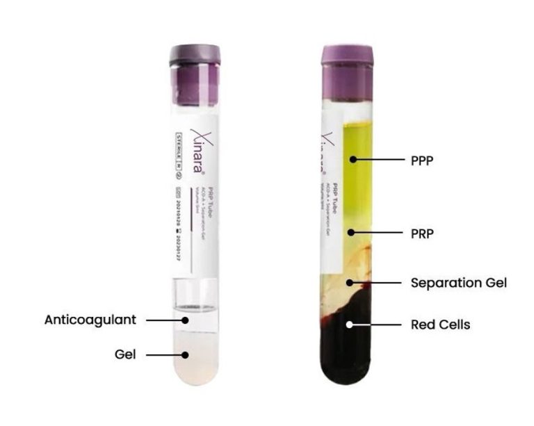 PRP Tube 3